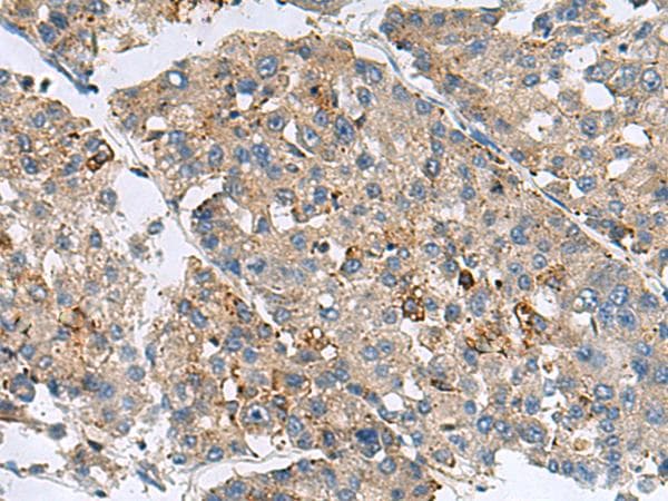 MED31 Antibody