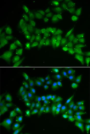 IHC-plus™ Polyclonal Rabbit anti-Human ISLET-1 / ISL1 Antibody (IHC, IF, WB)