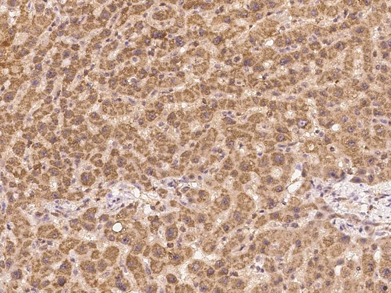 GCAT Antibody