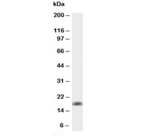 TNF Alpha Antibody (aa80-235)