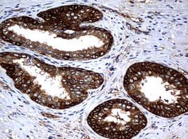 NME1 / NM23 Antibody (clone OTI3F2, Carrier-free)