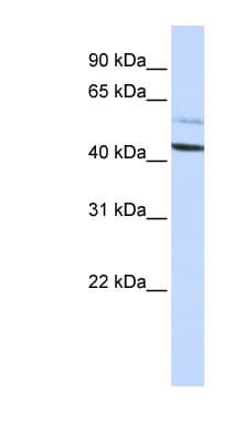 PSMD4 / RPN10 Antibody (N-Terminus)