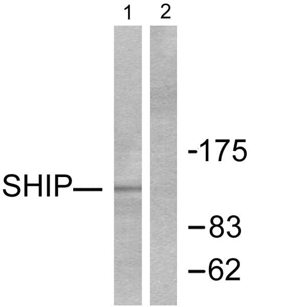 IHC-plus™ INPP5D / SHIP1 / SHIP Antibody (aa1140-1189)
