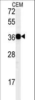 CD300LB Antibody (aa57-85)
