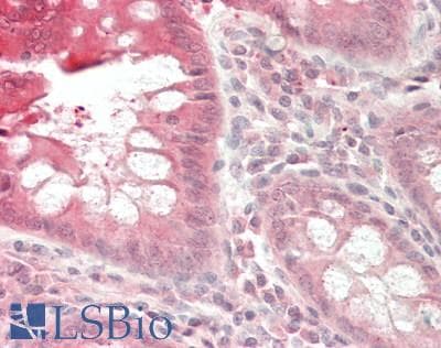 DHRS9 Antibody (HRP)