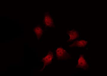 Polyclonal Rabbit anti-Human NOS3 / eNOS Antibody (phospho-Thr494, IF, WB)