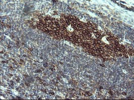 Monoclonal Mouse anti-Human CD45 / LCA Antibody (clone OTI2E7, IHC, IF, WB)