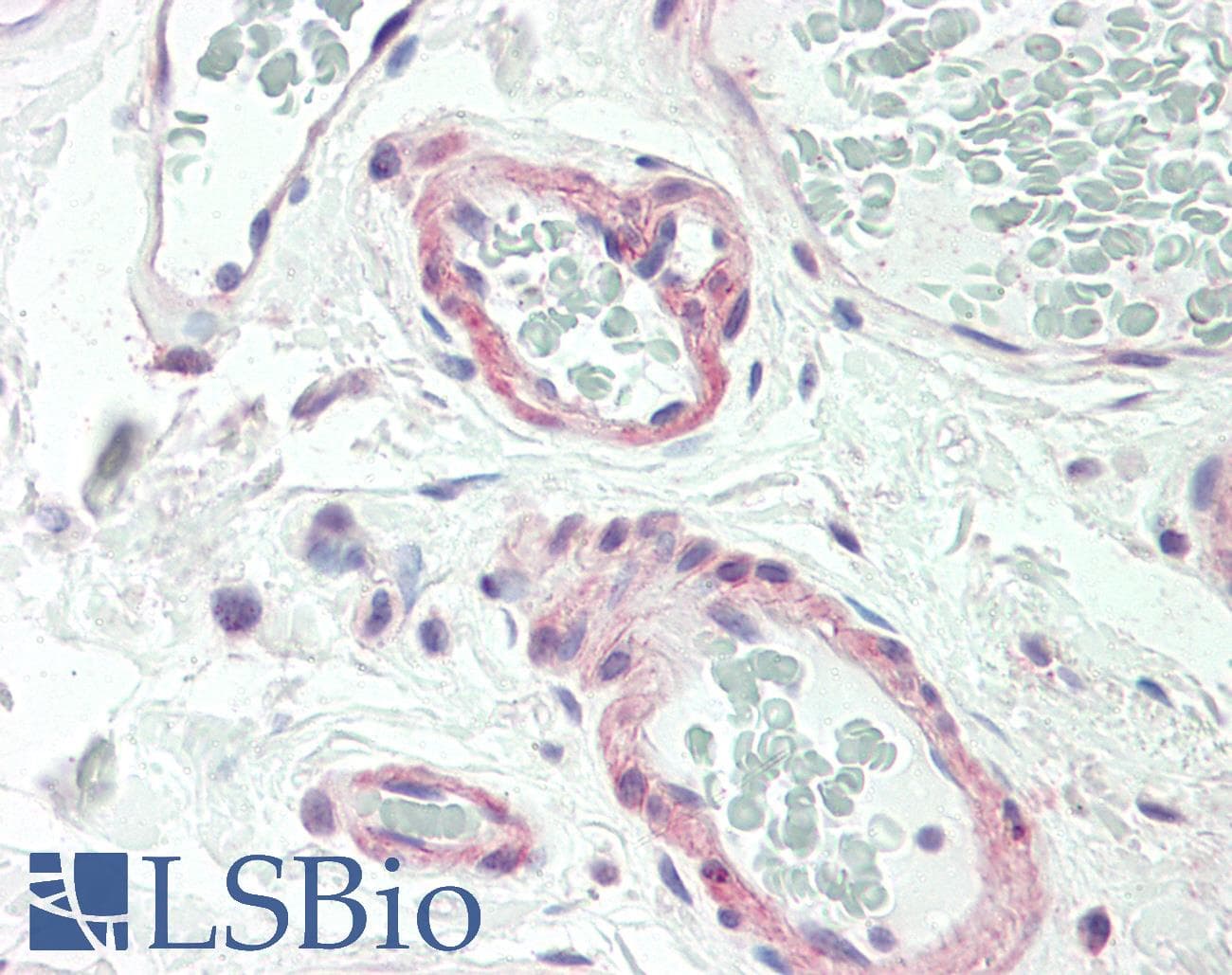 IHC-plus™ CALCR / Calcitonin Receptor Antibody (aa445-474)
