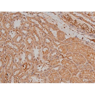 Polyclonal Rabbit anti-Human SP1 Antibody (phospho-Thr739, IHC, IF, WB)