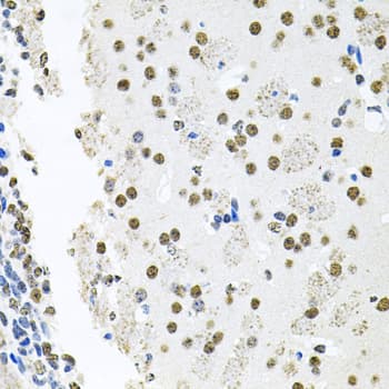 Polyclonal Rabbit anti-Human MCL1 / MCL 1 Antibody (IHC, IF, WB)