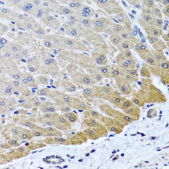 ARSF / Arylsulfatase F Antibody