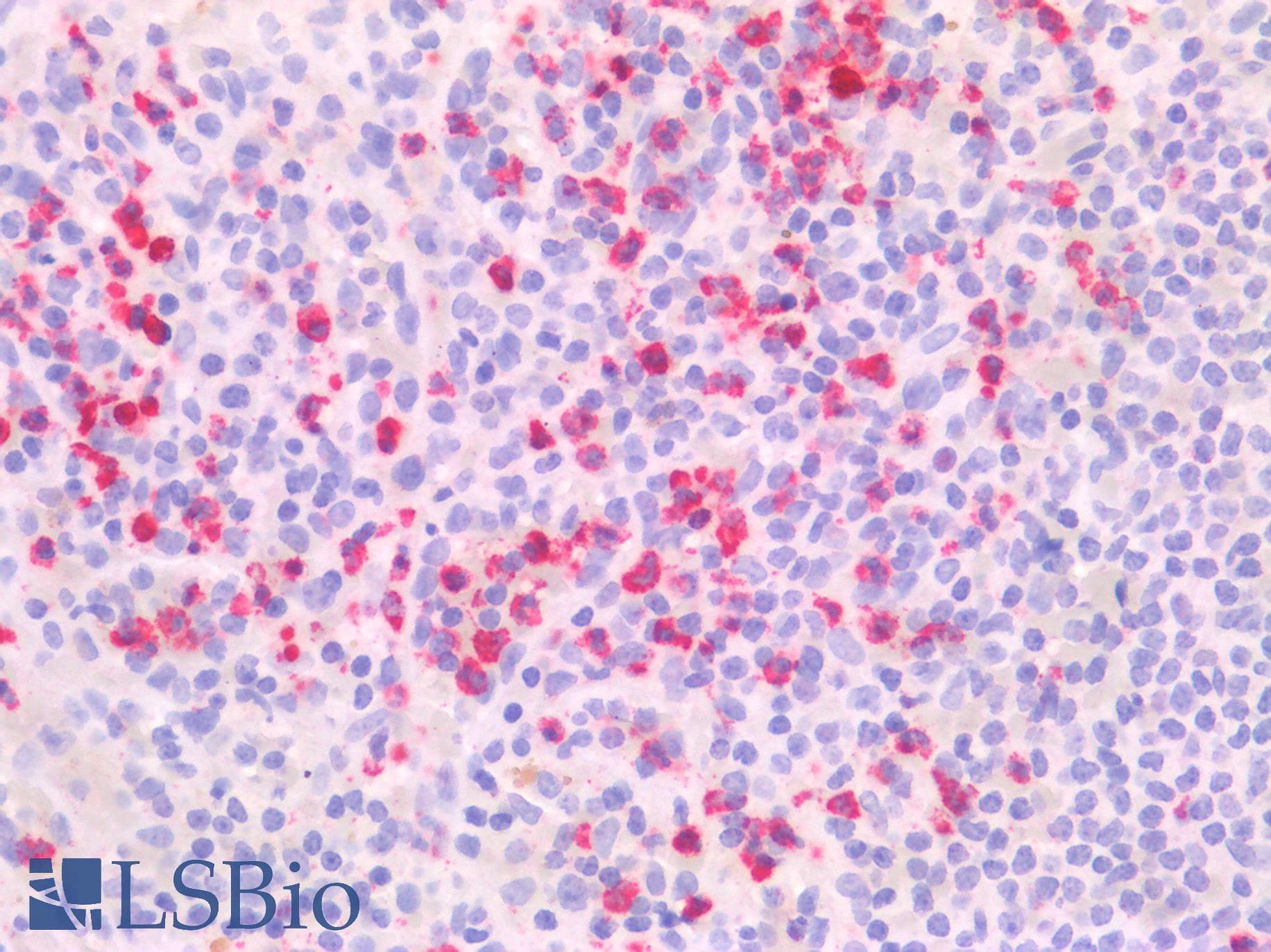 PathPlus™ SSEA-1 / Lewis x / CD15 Antibody (clone MC-480)