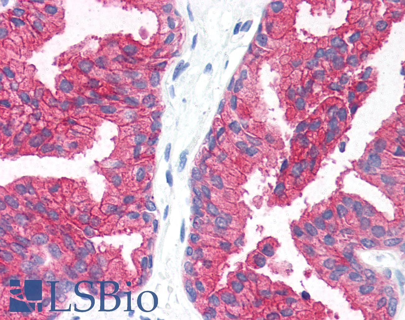 IHC-plus™ CD38 Antibody (clone HIT2)
