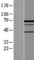 PALMD Protein (Over-Expression Lysate Myc-DDK (Flag))