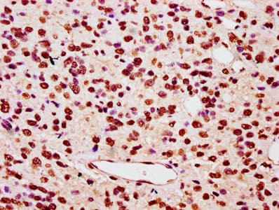 Polyclonal Rabbit anti-Human HIST1H3A Antibody (IHC, WB)