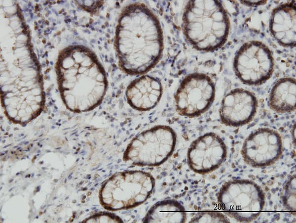 Monoclonal Mouse anti-Human EPHB3 / EPH Receptor B3 Antibody (clone 2G8, IHC, WB)
