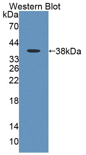 MLYCD / MCD Antibody (aa191-493, Biotin)