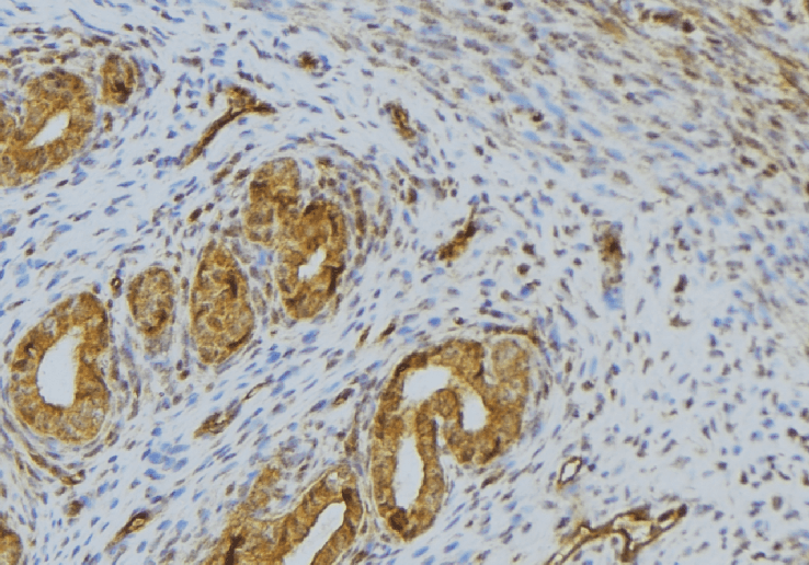 PPIA / Cyclophilin A Antibody
