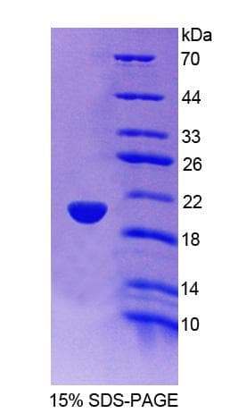 Human TRIM3 Protein (Recombinant His-T7)