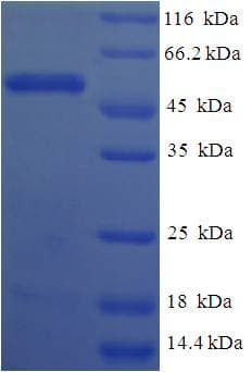 Human M-PST / STM Protein (Recombinant His-SUMO)