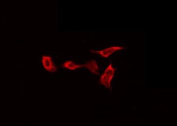 GYS1 / Glycogen Synthase Antibody