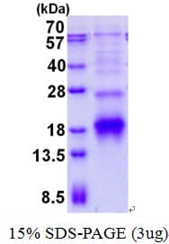 Human POLR2I Protein (Recombinant His)