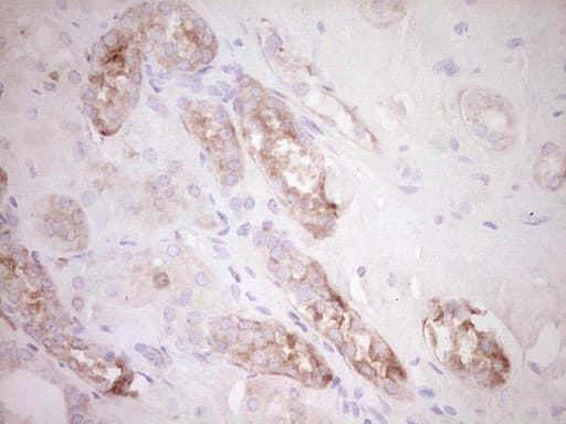 Monoclonal Mouse anti-Human FOS / c-FOS Antibody (clone OTI1F3, IHC)