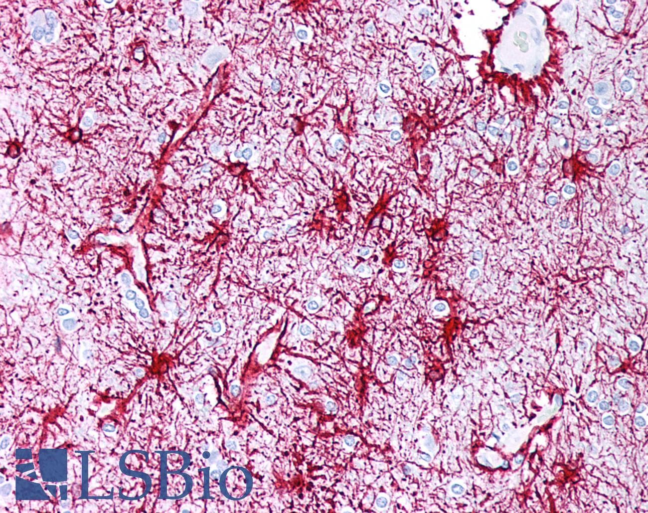 PathPlus™ GFAP Antibody (clone ABT-GFAP)