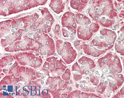 IHC-plus™ Polyclonal Rabbit anti-Human IL12A / p35 Antibody (aa16-65, IHC, WB)