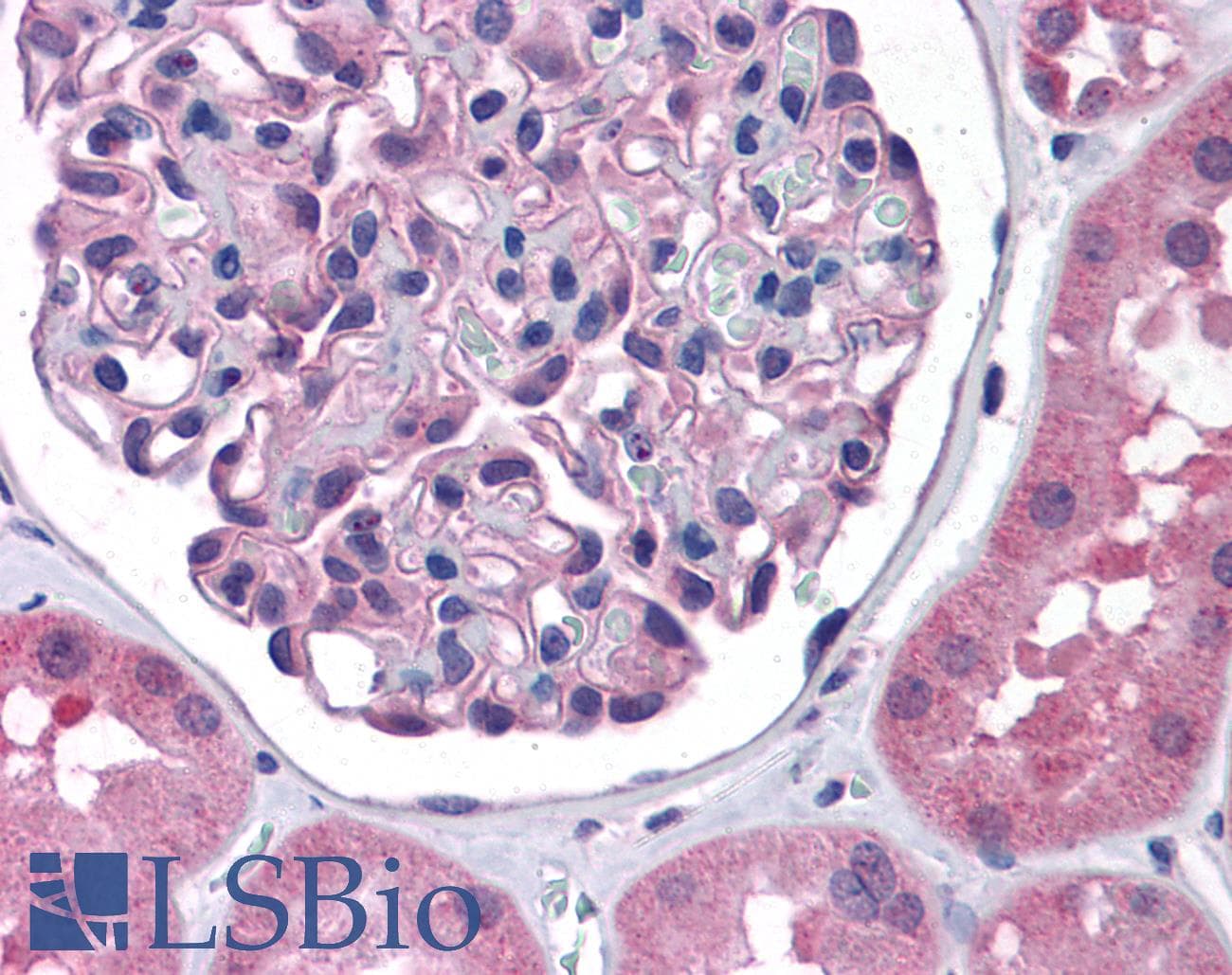 IHC-plus™ Polyclonal Rabbit anti-Human NPHS1 / Nephrin Antibody (IHC)
