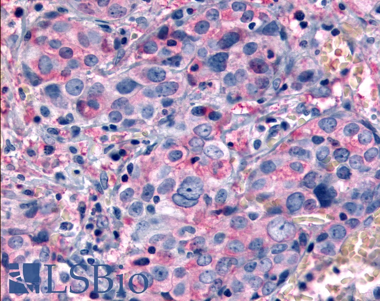 PathPlus™ GRM6 / MGLUR6 Antibody (N-Terminus)