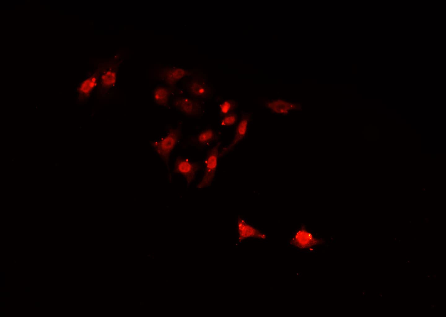 Polyclonal Rabbit anti-Human SIAH2 Antibody (IHC, IF, WB)