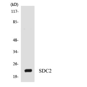 IHC-plus™ SDC2 / Syndecan 2 Antibody (aa65-114)