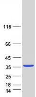 Human Latexin / MUM Protein (Recombinant Myc-DDK (Flag))