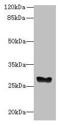 GPM6B Antibody