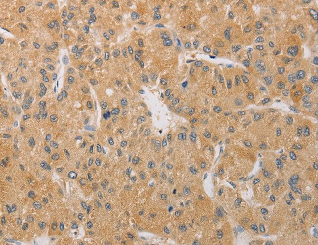Polyclonal Rabbit anti-Human ARSK / Arylsulfatase K Antibody (IHC)