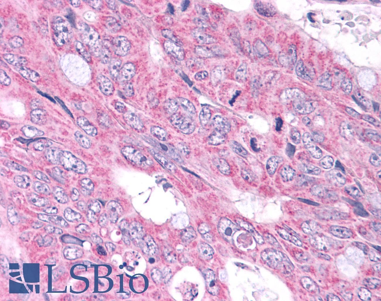 PathPlus™ NEK6 Antibody (N-Terminus)