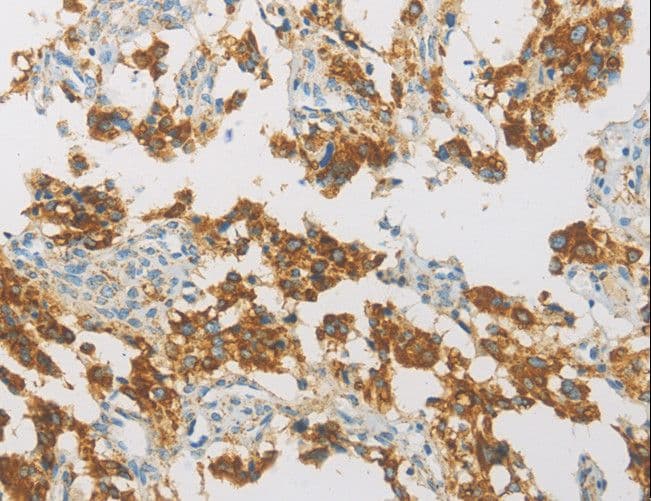 IDH3G Antibody