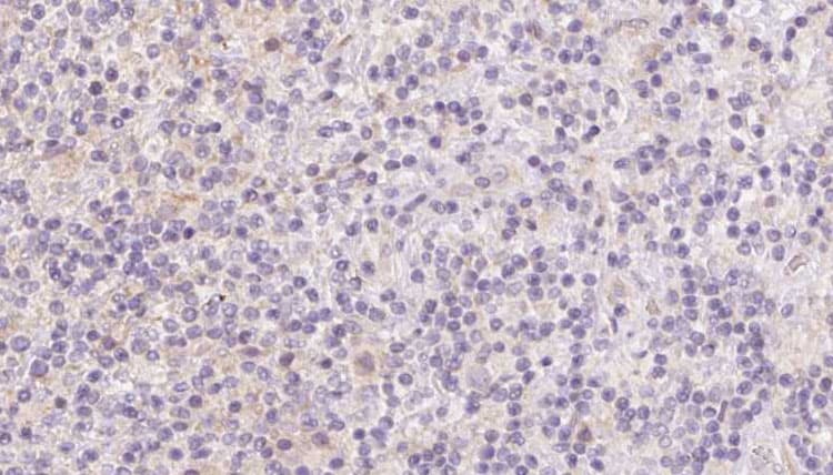 BBS7 Antibody