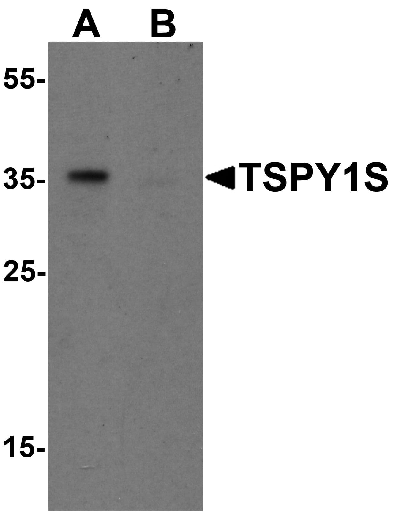 IHC-plus™ TSPY1 / TSPY Antibody