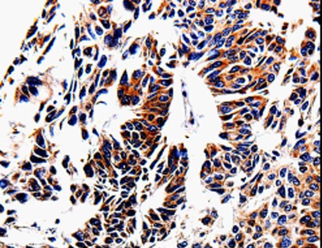 ACSBG2 Antibody