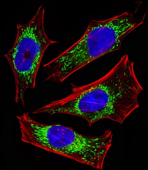 ETFA Antibody (aa192-226)