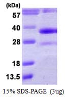 Human DHRS4 / PSCD Protein (Recombinant His)