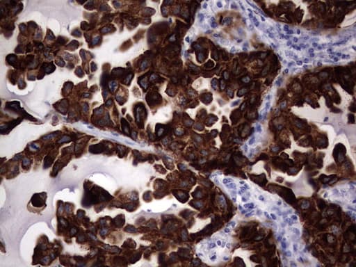 KRT19 / CK19 / Cytokeratin 19 Antibody (aa240-390, clone OTI3D10)