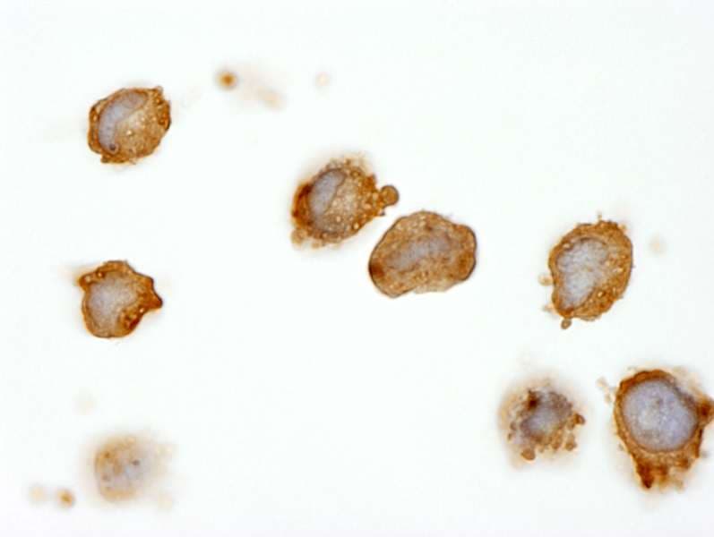 Polyclonal Rabbit anti-Human CML / BCR Antibody (aa50-100, IF)