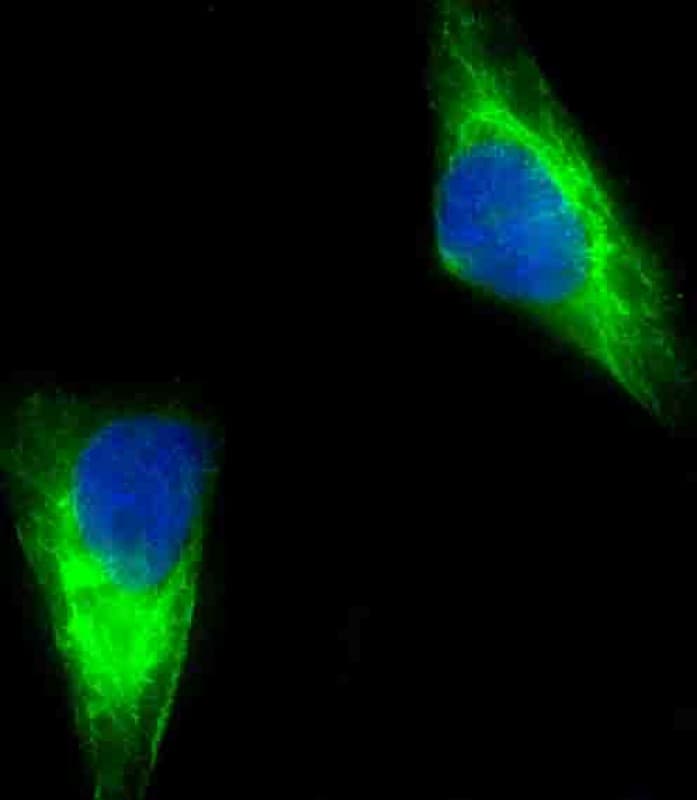 MUT / MCM Antibody (Internal)