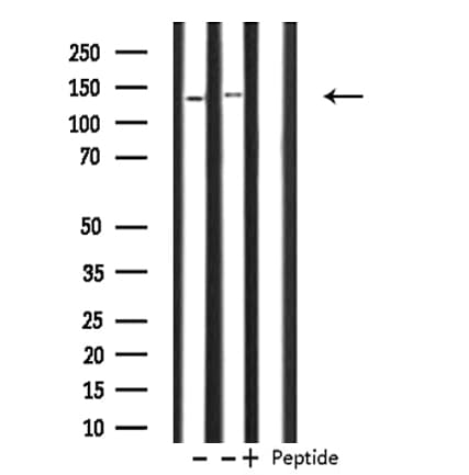 PHKA1 + PHKA2 Antibody