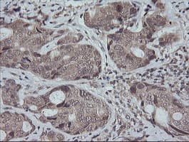 MAP2K3 / MEK3 / MKK3 Antibody (clone OTI5C7, Carrier-free)
