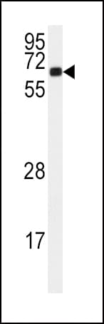CAMK2A / CaMKII Alpha Antibody (aa344-371)