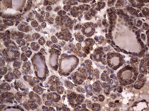DOCK8 Antibody (aa832-1160, clone OTI4H10)